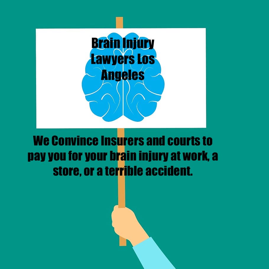Brain injury lawyers Los Angeles. Why Is My Loved One Changed After A Brain Injury? How Can The Expert Help?